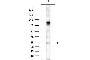 anti-Myeloid Leukemia Factor 1 (MLF1) (Internal Region) antibody