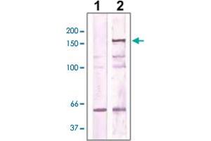 The cell lysate derived from NIH/3T3 was immunoprecipitated by ROCK2 polyclonal antibody , then immunoprobed by the same antibody at 1 : 500 (lane 2). (ROCK2 Antikörper  (AA 250-350))