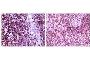 Immunohistochemical analysis of paraffin-embedded human thymoma tissue (left) and spleen tissue (right), showing cytoplasmic localization using MAP2K4 antibody with DAB staining. (MAP2K4 Antikörper)