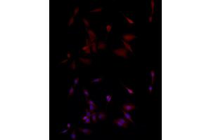 Immunofluorescence analysis of PC-12 cells using PGP9. (UCHL1 Antikörper  (AA 1-220))