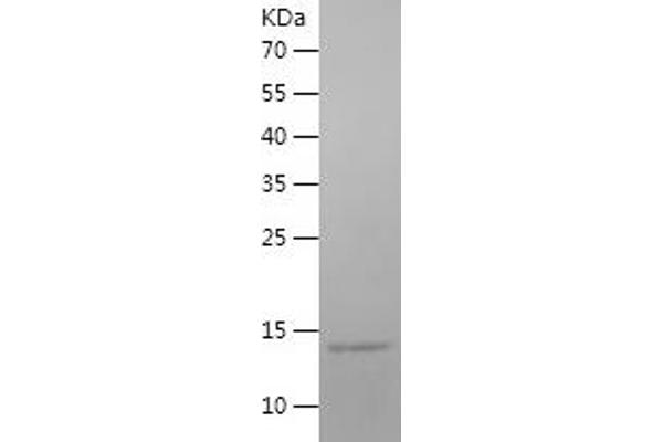 ATP6V1G3i Protein (AA 1-118) (His tag)