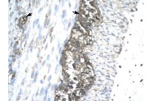 ACAT2 antibody was used for immunohistochemistry at a concentration of 4-8 ug/ml to stain Ganglionic cells (arrows) in Human Stomach. (ACAT2 Antikörper)