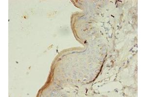 Immunohistochemistry of paraffin-embedded human skin tissue using ABIN7154151 at dilution of 1:100 (GK3P Antikörper  (AA 1-220))