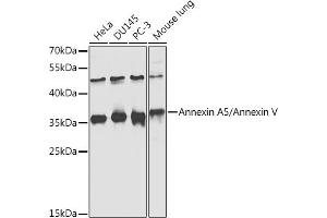 Western blot analysis of extracts of various cell lines, using Annexin /Annexin V antibody  at 1:1000 dilution. (Annexin V Antikörper  (AA 1-320))