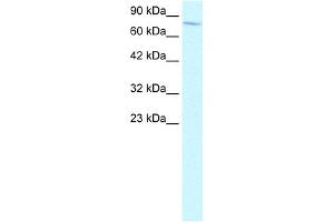 WB Suggested Anti-ENG Antibody Titration:  2. (Endoglin Antikörper  (N-Term))
