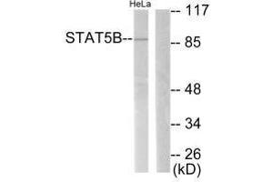 Western blot analysis of extracts from RAW264. (STAT5B Antikörper  (Ser731))