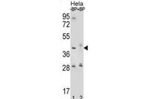 Western Blotting (WB) image for anti-Hyaluronidase-2 (HYAL2) antibody (ABIN2996780)