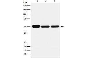Western blot analysis of GLUR expression in (1) HeLa cell lysate, (2) Mouse brain lysate, (3) Rat kidney lysate.