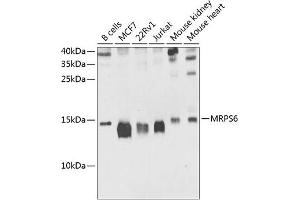 Western blot analysis of extracts of various cell lines, using MRPS6 antibody (ABIN6133092, ABIN6144048, ABIN6144049 and ABIN6225227) at 1:1000 dilution. (MRPS6 Antikörper  (AA 1-125))