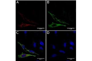 Immunofluorescence staining of fixed HeLa cells expressing mCherry tagged GCN4 with anti-GCN4 antibody C11L34. (Rekombinanter GCN4 Antikörper)
