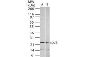 Image no. 1 for anti-Suppressor of Cytokine Signaling 1 (SOCS1) (AA 54-68) antibody (ABIN233230) (SOCS1 Antikörper  (AA 54-68))