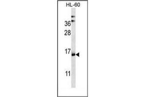 Western blot analysis of NDUFAF4 Antibody (N-term) in HL-60 cell line lysates (35ug/lane).