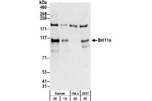 Western Blotting (WB) image for anti-B-Cell CLL/lymphoma 11A (Zinc Finger Protein) (BCL11A) (AA 450-500) antibody (ABIN7450024)