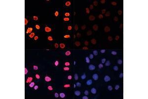 Immunofluorescence analysis of HeLa cells using Acetyl-Histone H3-K18 antibody (ABIN7267668) at dilution of 1:100. (Histone 3 Antikörper  (H3K18))