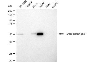 Western blotting analysis using tumor protein p53 antibody (ABIN7800685).