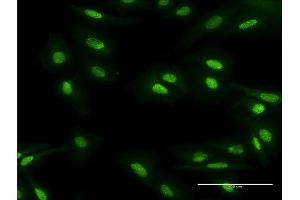 Immunofluorescence of monoclonal antibody to MBD5 on HeLa cell. (MBD5 Antikörper  (AA 1-229))