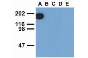 Western Blotting (WB) image for anti-Epidermal Growth Factor Receptor (EGFR) (pTyr1197) antibody (ABIN400879) (EGFR Antikörper  (pTyr1197))
