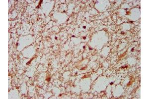 IHC image of ABIN7155757 diluted at 1:600 and staining in paraffin-embedded human brain tissue performed on a Leica BondTM system. (HOXD1 Antikörper  (AA 59-131))