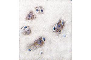 anti-Cytochrome P450, Family 26, Subfamily C, Polypeptide 1 (CYP26C1) (AA 410-439), (C-Term) antibody