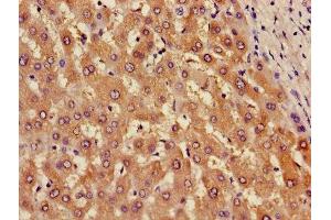 Immunohistochemistry of paraffin-embedded human liver tissue using ABIN7143681 at dilution of 1:100