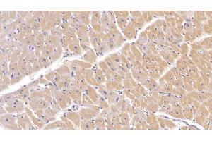 Immunohistochemistry (IHC) image for anti-Procollagen III N-Terminal Propeptide (PIIINP) antibody (ABIN7428533)