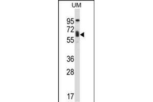 TCF3 Antibody (C-term) (ABIN657912 and ABIN2846860) western blot analysis in human uterine tumor tissue lysates (35 μg/lane). (TCF3 Antikörper  (C-Term))