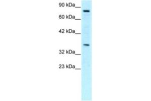 Western Blotting (WB) image for anti-Neuronal PAS Domain Protein 1 (NPAS1) antibody (ABIN2460366)