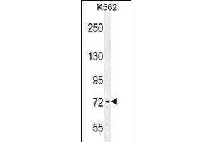 K6 Antibody (Center) (ABIN656098 and ABIN2845441) western blot analysis in K562 cell line lysates (35 μg/lane).