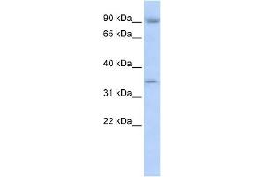 WB Suggested Anti-NFKBIB Antibody Titration:  0.
