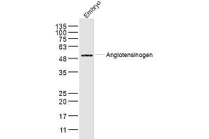 Mouse embryo lysates probed with Angiotensinogen Polyclonal Antibody, Unconjugated  at 1:300 dilution and 4˚C overnight incubation. (AGT Antikörper  (AA 51-120))