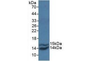 Detection of Recombinant MCP1, Simian using Polyclonal Antibody to Monocyte Chemotactic Protein 1 (MCP1) (CCL2 Antikörper  (AA 24-99))