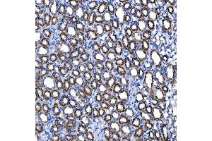 IHC analysis of SUCLG2 using anti-SUCLG2 antibody (ABIN7601694). (SUCLG2 Antikörper  (AA 42-424))