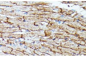 Immunohistochemistry of paraffin-embedded Mouse heart using SLC14A1 Polyclonal Antibody at dilution of 1:100 (40x lens).