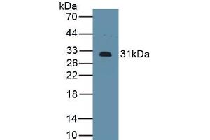 Detection of Recombinant IL2Ra, Mouse using Polyclonal Antibody to Interleukin 2 Receptor Alpha (IL2Ra) (CD25 Antikörper  (AA 22-235))