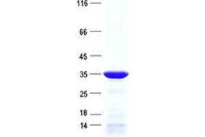Validation with Western Blot (PPTC7 Protein (His tag))