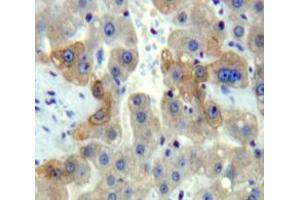 Used in DAB staining on fromalin fixed paraffin-embedded Liver tissue (DISC1 Antikörper  (AA 151-340))