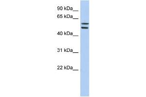 WB Suggested Anti-ZNF513 Antibody Titration:  0. (ZNF513 Antikörper  (Middle Region))