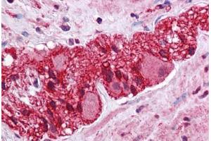Human Colon, Myenteric Plexus: Formalin-Fixed, Paraffin-Embedded (FFPE) (LMBRD1 Antikörper  (C-Term))