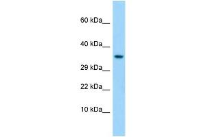 Western Blotting (WB) image for anti-Taste Receptor, Type 1, Member 1 (TAS1R1) (C-Term) antibody (ABIN2790236)