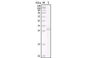 Western blot analysis using HER-2 mouse mAb against truncated HER-2 recombinant protein. (ErbB2/Her2 Antikörper)