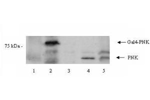 Western blot using  Affinity Purified anti-PNK antibody shows detection of a 57 kDa band corresponding to human PNK in a Y190 yeast cell lysate (lane 1), Y190 yeast cell lysate + human PNK (Gal DNA BP) (lane 2), EM9 XH Chinese hamster ovary cell lysate (lane 3), EM9 XH Chinese hamster ovary cell lysate + human PNK (lane 4) and a HeLa cell lysate (lane 5).