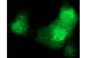 Image no. 1 for anti-Catenin (Cadherin-Associated Protein), beta 1, 88kDa (CTNNB1) antibody (ABIN1496891) (CTNNB1 Antikörper)