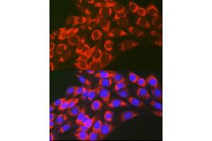 Immunofluorescence analysis of NIH-3T3 cells using TFEB Rabbit pAb (ABIN6128819, ABIN6149043, ABIN6149045 and ABIN6223149) at dilution of 1:100 (40x lens). (TFEB Antikörper)