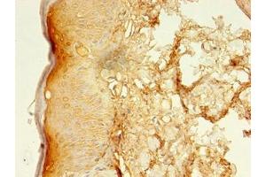 Immunohistochemistry of paraffin-embedded human skin tissue using ABIN7158219 at dilution of 1:100 (LSMEM2 Antikörper  (AA 1-96))