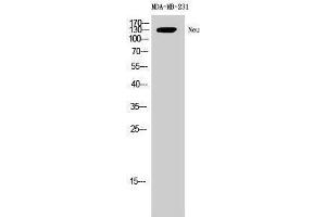 Western Blotting (WB) image for anti-Neuralized Homolog (Drosophila) (NEURL) (Ser352) antibody (ABIN6285191)