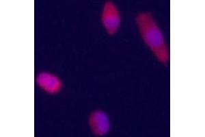 Immunofluorecence staining of Glypican 3 antibody on HepG2 cells. (Glypican 3 Antikörper  (AA 335-365))