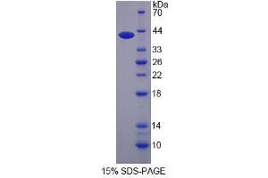 Image no. 1 for AHNAK Nucleoprotein (AHNAK) (AA 1-300) protein (His tag) (ABIN6237268) (AHNAK Protein (AA 1-300) (His tag))