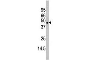 Western blot analysis of MAPK11 antibody and mouse heart tissue lysate (MAPK11 Antikörper  (AA 334-359))
