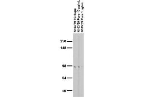 Adult rat brain membrane (RBM) immunoblot.