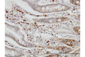 Immunoperoxidase of monoclonal antibody to CDH18 on formalin-fixed paraffin-embedded human small Intestine. (CDH18 Antikörper  (AA 467-576))